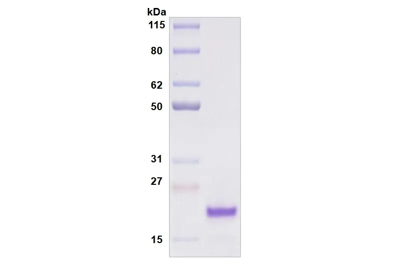 Recombinant Human Siglec-8, His Tag -100 ug